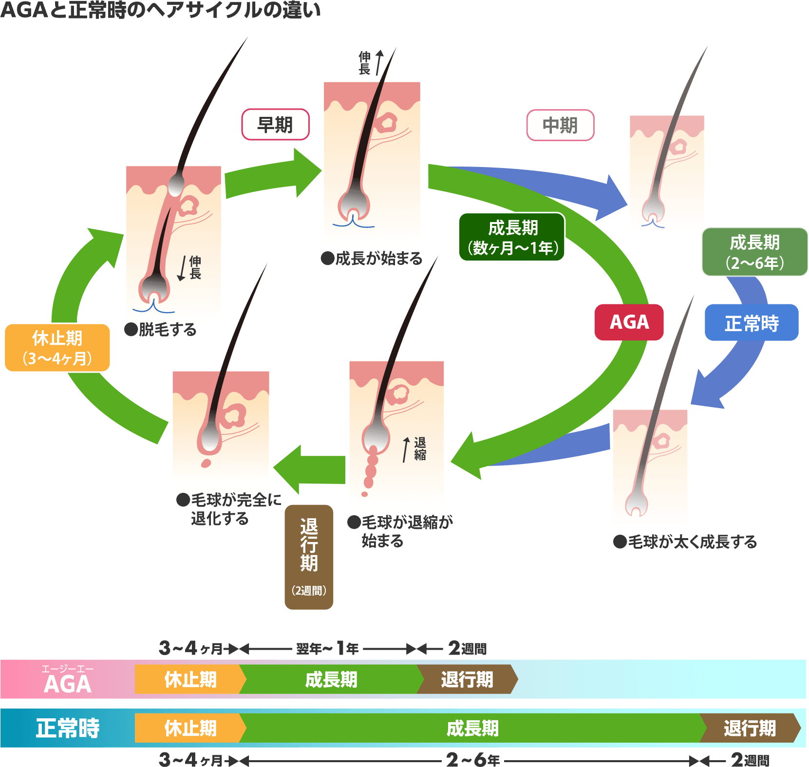 薄毛のメカニズムの図